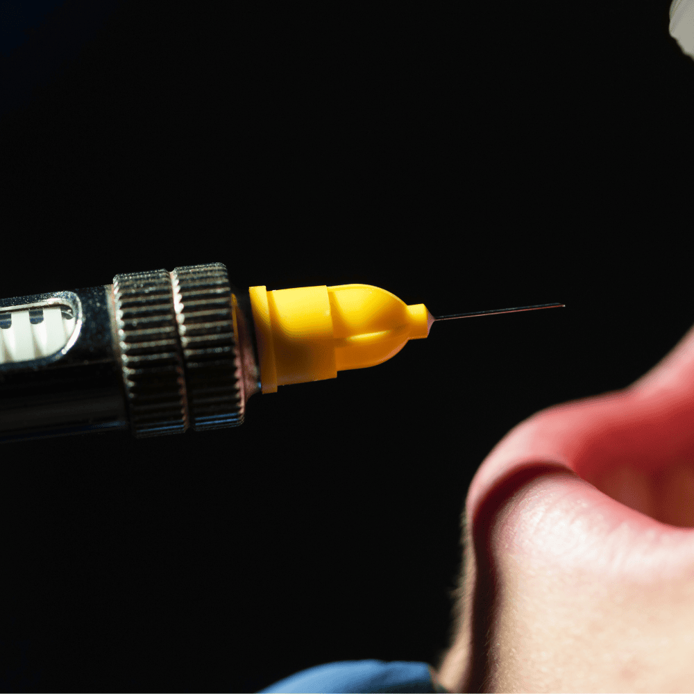 Agujas de anestesia dental