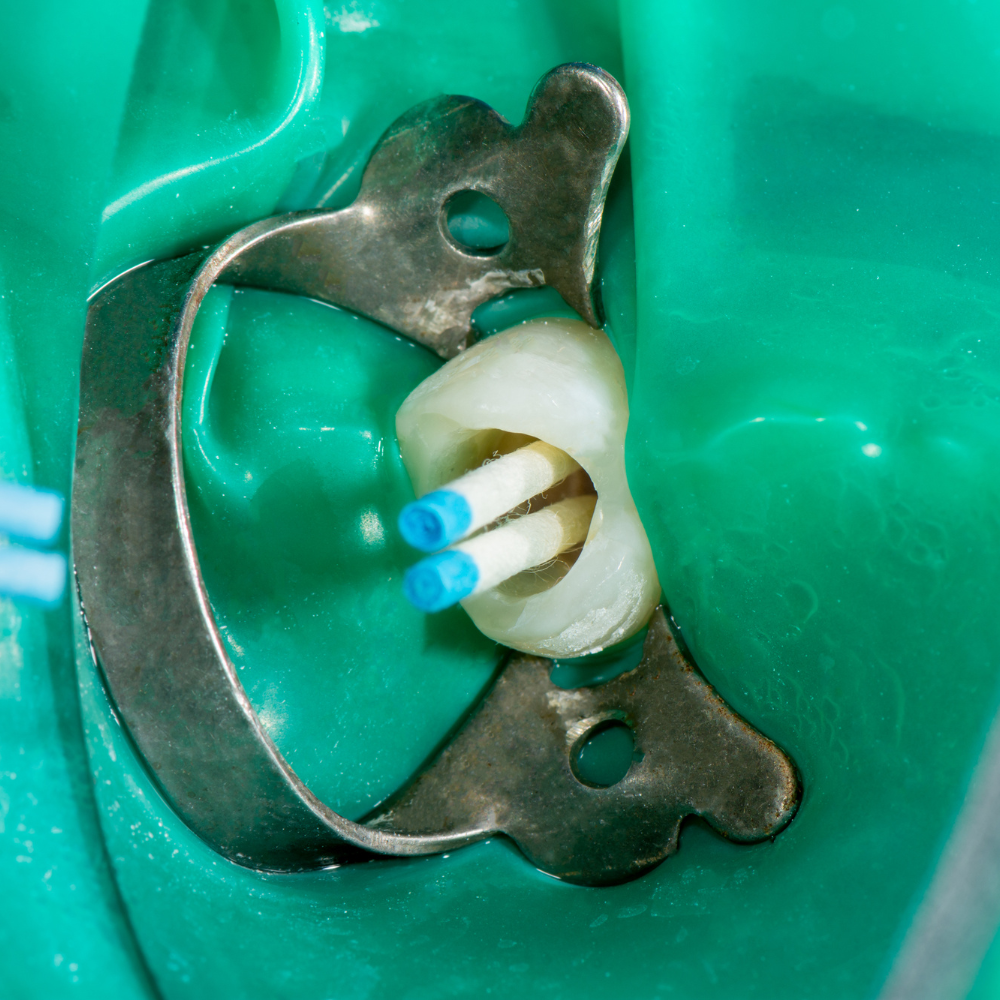 Clamps