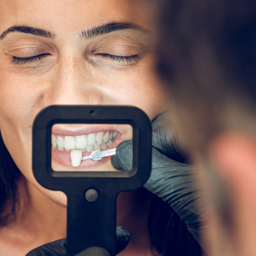 Fotografía Dental