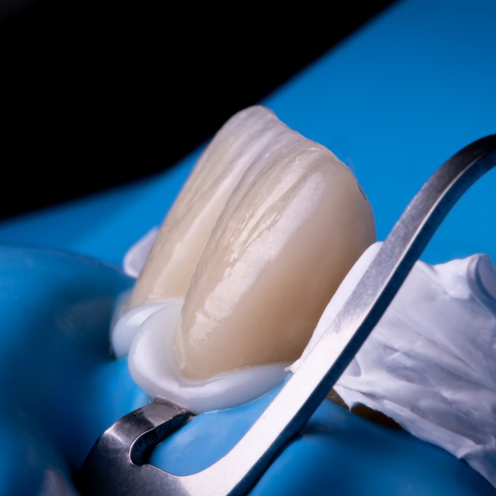 Retracción Gingival