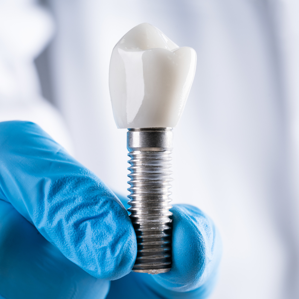 Accesorios para Implantes de Conexión Interna