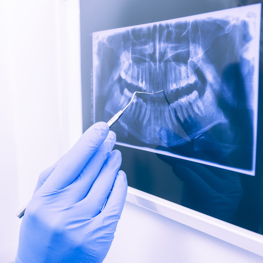 Digitalizador de Placas