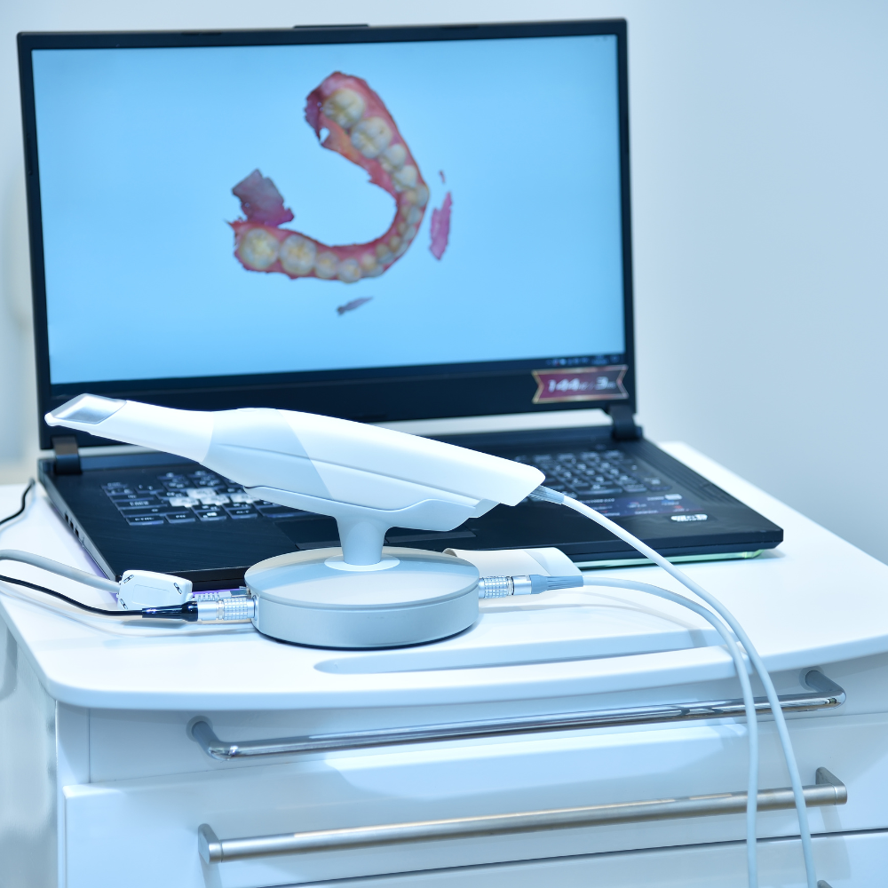 Escáner Intraoral