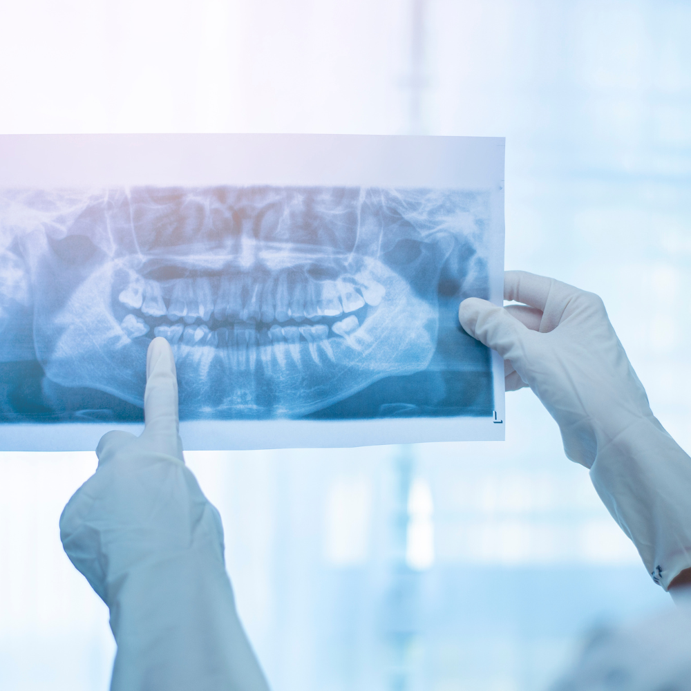 Equipamiento de radiología dental