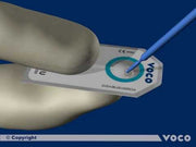 Adhesivo universal de curado dual Futurabond U Voco 