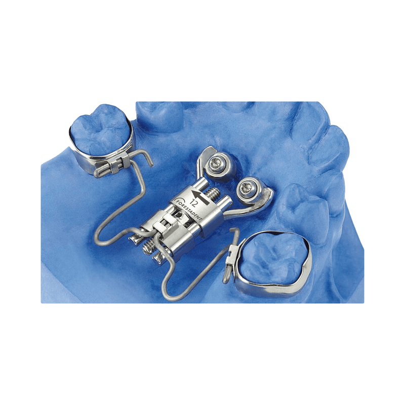 Tornillos para Frog II (Rana) Distalizador-de Molares Simplificado Forstadent